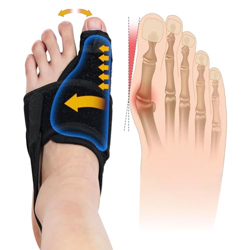 Bunion Corrector for Women & Men, Orthopedic Bunion Splint for Hallux Valgus Pain Relief, Big Toe Separator, Adjustable Day/Night Support, Comfortable Hammer Toe Straightener, left£¨Black£©