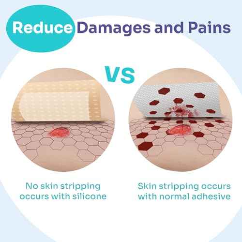 Conkote Silicone Foam Dressings 2'' X 2'', Large Bandages for Wound Care, Box of 10 Dressings